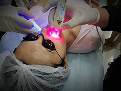 Venda de Aparelho de Laserterapia em São Carlos